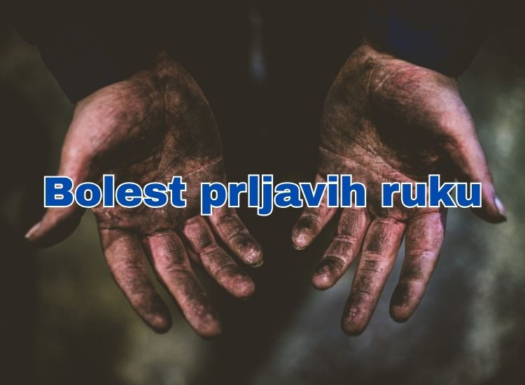 bolest prljavih ruku bolest prljavih ruku koksaki virus bolest prljavih ruku koksaki virus kod dece osip bolest prljavih ruku kod dece bolest prljavih ruku i nogu bolest prljavih ruku kod odraslih bolest prljavih ruku nogu i usta