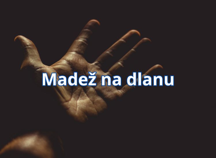 madež na dlanu