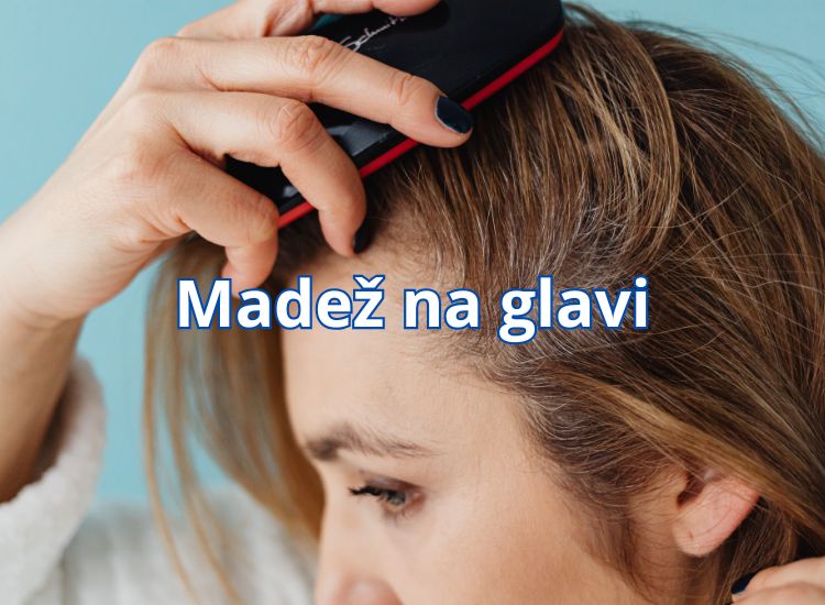 madež na glavi u kosi