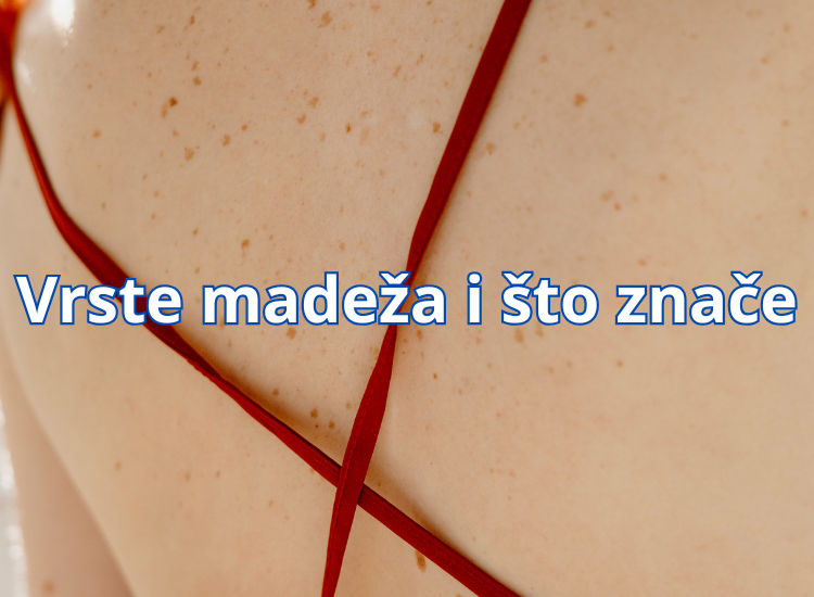 madež na stopalu madež na tabanu madež na glavi u kosi madež na lijevom dlanu madež na nosu crni madež na kozi madež na dlanu kako ukloniti madež na licu madež na usni melanocitni madež madež madez crni madež crni madež na leđima madež se osušio i otpao madež koji svrbi madež na glavi kongenitalni madež kako ukloniti madež na prirodan način što kad otpadne madež madež koji pecka kako ukloniti madež kako ukloniti madez kod kuce