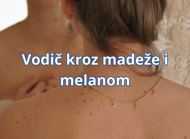 madež na stopalu madež na tabanu madež na glavi u kosi madež na lijevom dlanu madež na nosu crni madež na kozi madež na dlanu kako ukloniti madež na licu madež na usni melanocitni madež madež madez crni madež crni madež na leđima madež se osušio i otpao madež koji svrbi madež na glavi kongenitalni madež kako ukloniti madež na prirodan način što kad otpadne madež madež koji pecka kako ukloniti madež kako ukloniti madez kod kuce