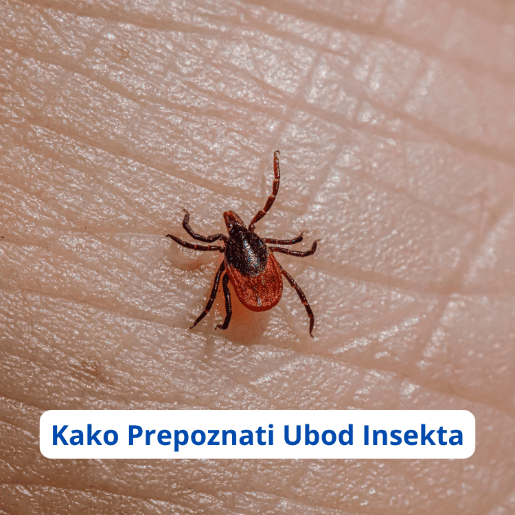 ubod insekta ubod insekta oteklina ubod insekta crvenilo i otok alergija na ubod insekta ubod insekta alergijska reakcija ubod insekta mkb ubod insekta ujed pauka ubod insekta mjehur kako prepoznati ubod insekta kako liječiti ubod insekta ubod insekta koji ne prolazi ubod insekta plikovi